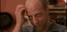 scratch-blister.gif